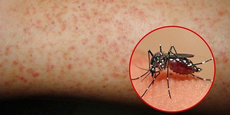 Những nguy hiểm của bệnh sốt xuất huyết